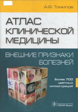 Атлас клинической медицины. Внешние признаки болезней